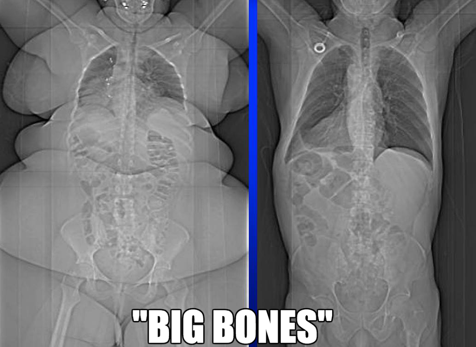 big bones