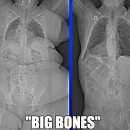 Are you “Big Boned”?